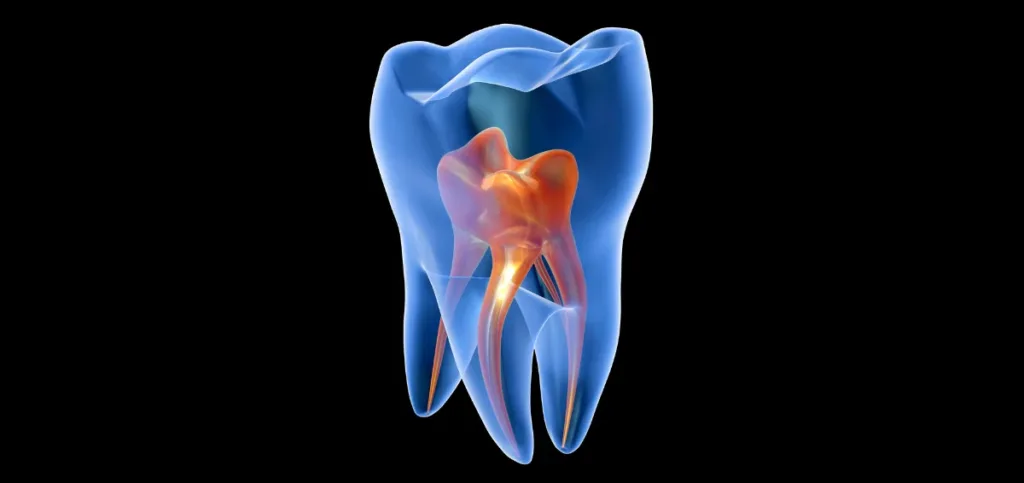 What Is a Tooth Infection