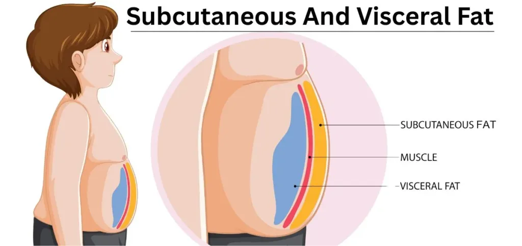 Subcutaneous And Visceral Fat